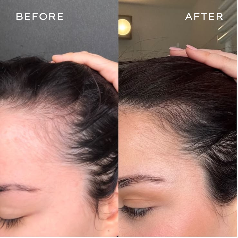 <p>Real Results in 3–6 Months</p>
