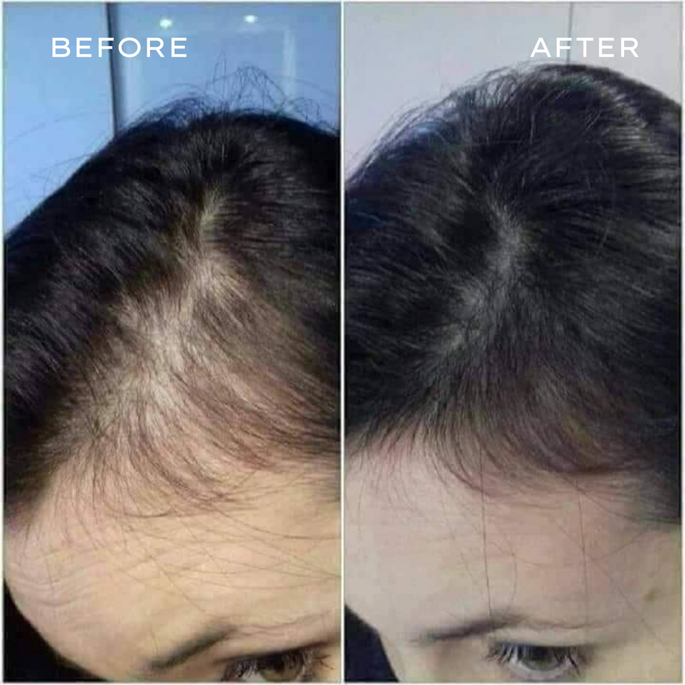 <p>Real Results in 3–6 Months</p>
