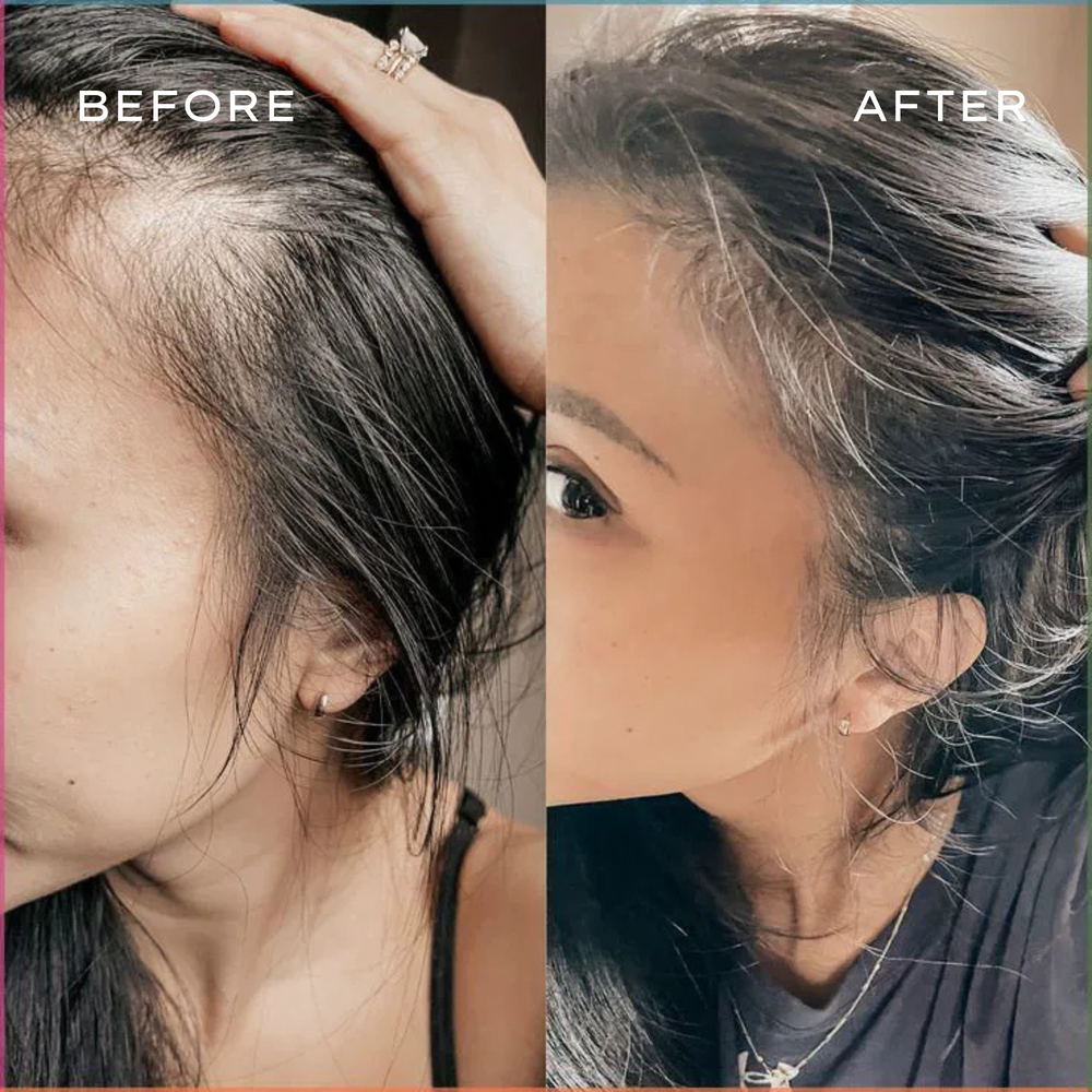 <p>Real Results in 3–6 Months</p>