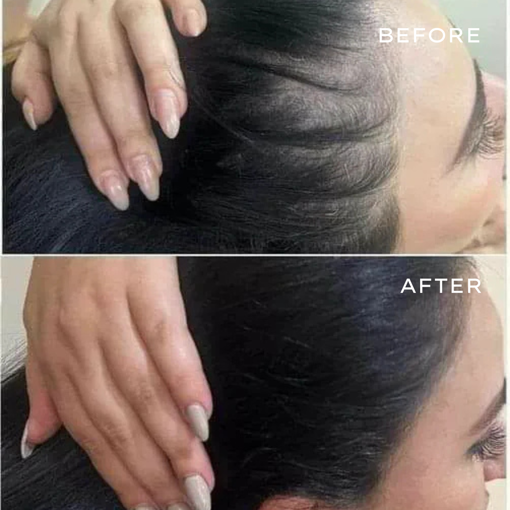 <p>Real Results in 3–6 Months</p>