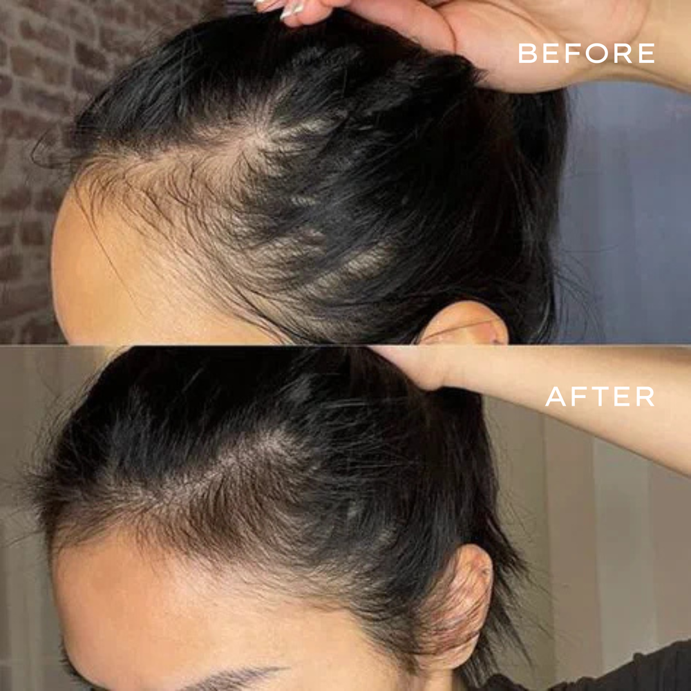 <p>Real Results in 3–6 Months</p>