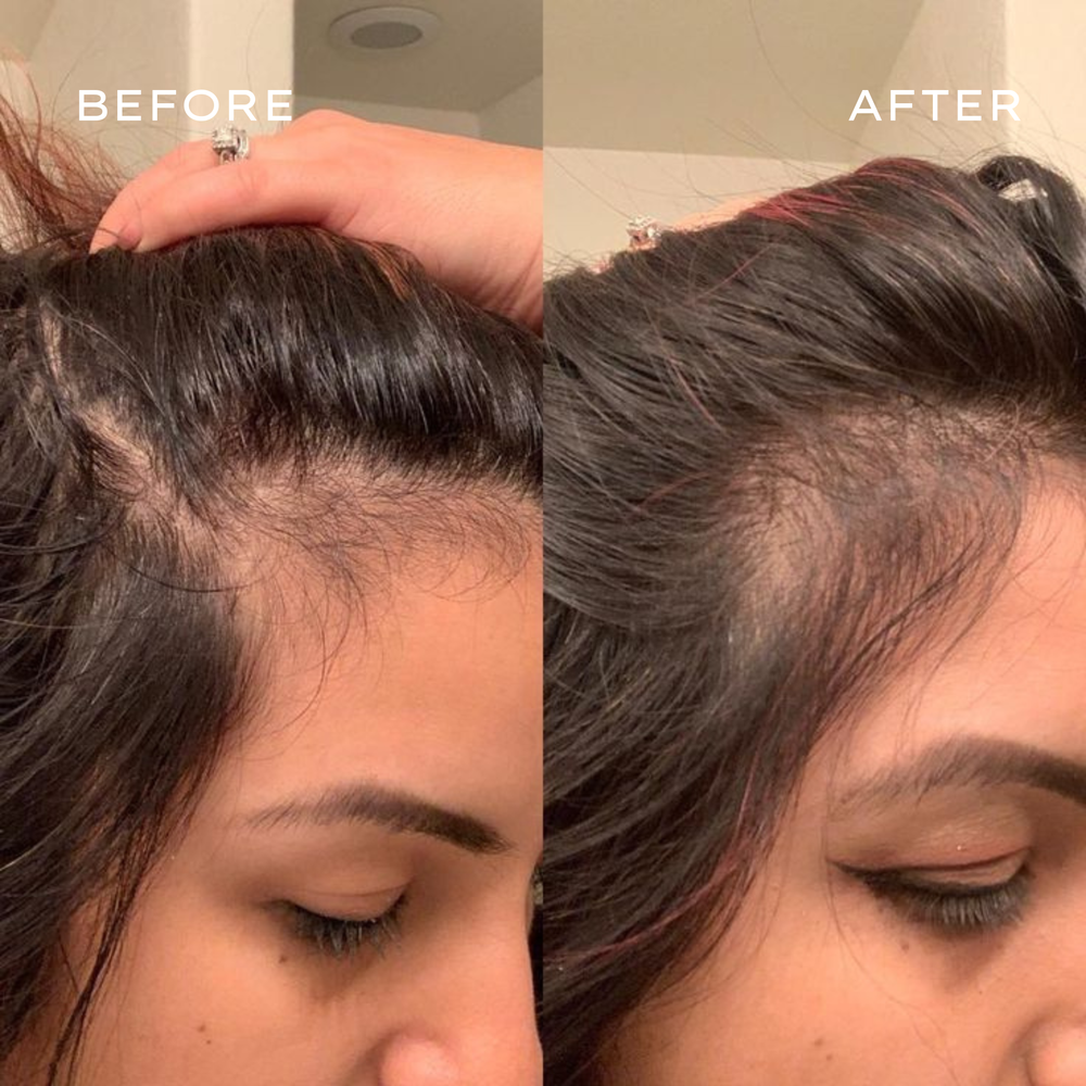 <p>Real Results in 3–6 Months</p>