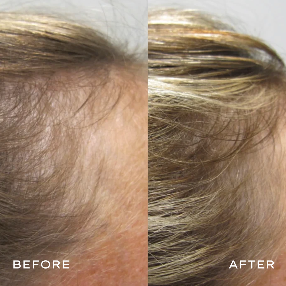 <p>Real Results in 3–6 Months</p>