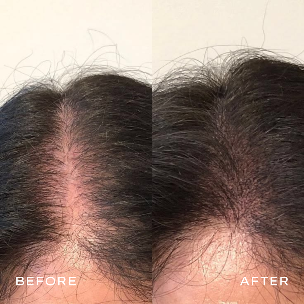 <p>Real Results in 3–6 Months</p>