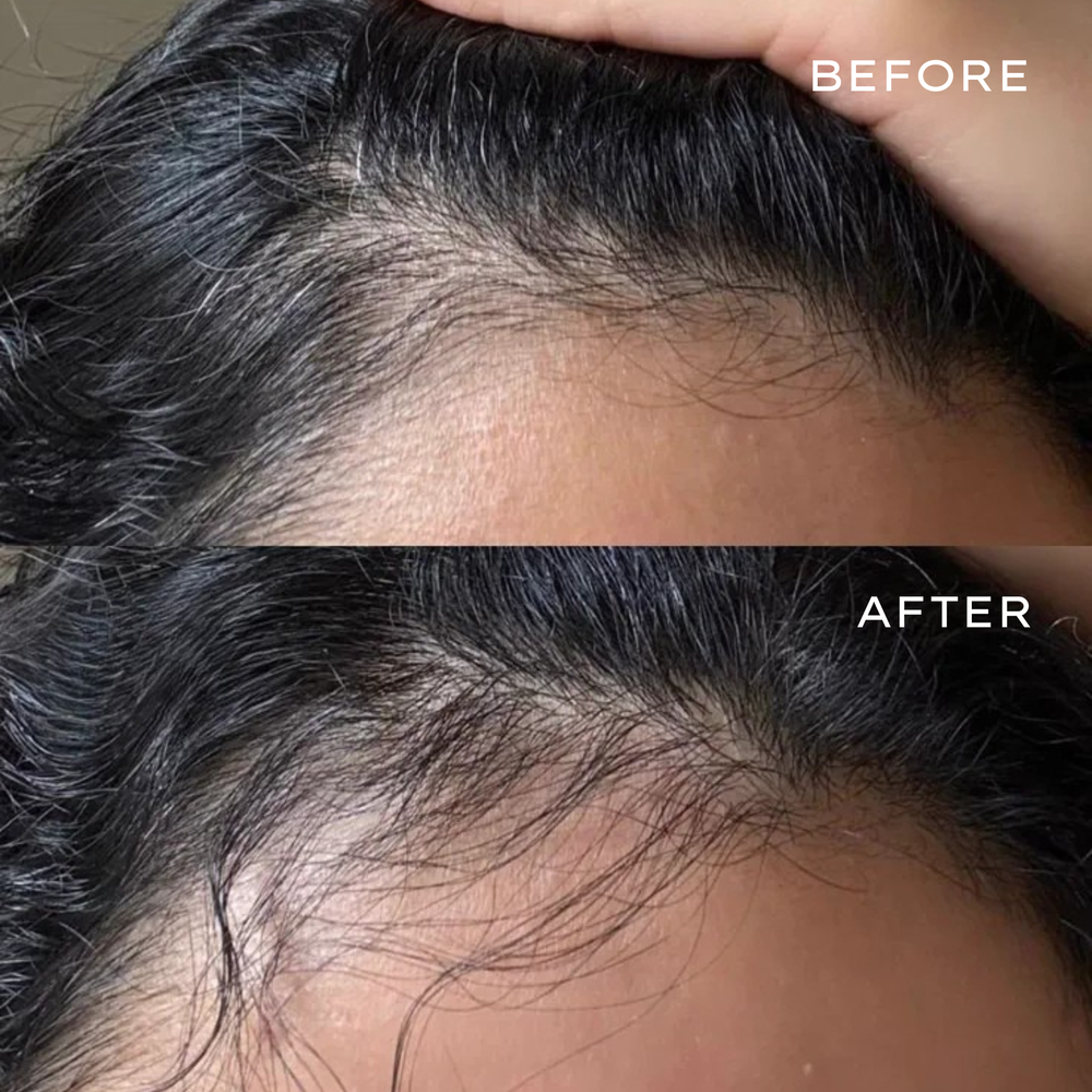 <p>Real Results in 3–6 Months</p>