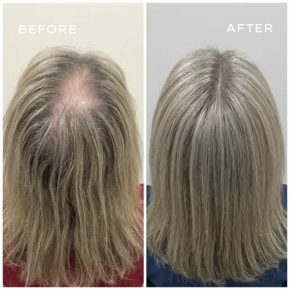 <p>Real Results in 3–6 Months</p>