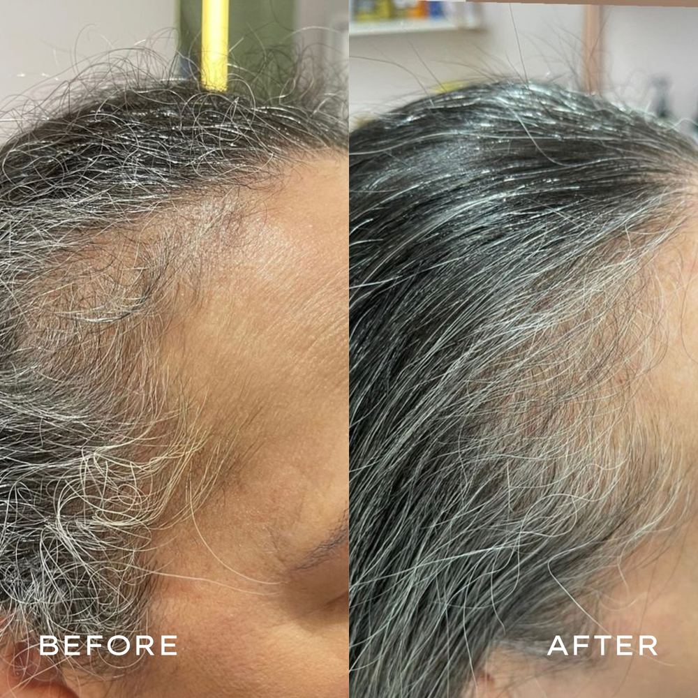 <p>Real Results in 3–6 Months</p>