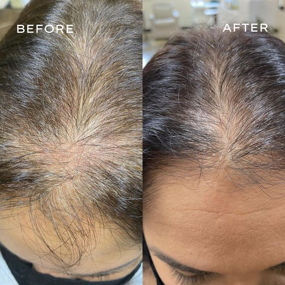 <p>Real Results in 3–6 Months</p>