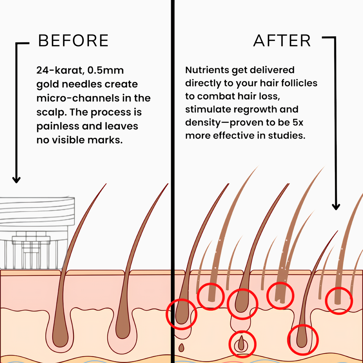 Reverse GLP-1 Hair Loss In 60 Days With Rootology™ Micro Infusion